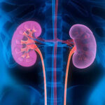 10 Health Facts About Kidneys