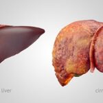 10 Health Facts About Liver