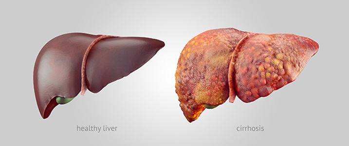 10 Health Facts About Liver