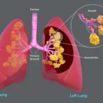 10 Health Facts About Lungs